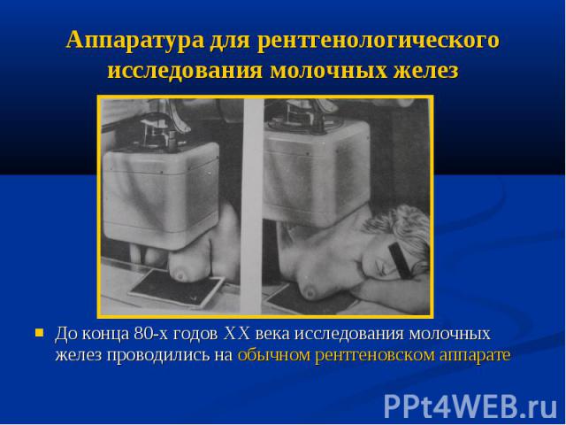 Аппаратура для рентгенологического исследования молочных желез До конца 80-х годов ХХ века исследования молочных желез проводились на обычном рентгеновском аппарате