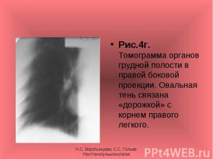 Рис.4г. Томограмма органов грудной полости в правой боковой проекции. Овальная т