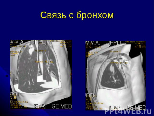 Связь с бронхом
