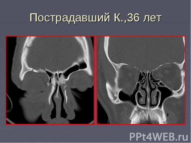 Пострадавший К.,36 лет