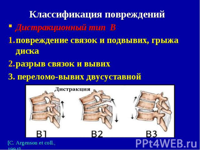 Дистракционный тип В Дистракционный тип В повреждение связок и подвывих, грыжа диска разрыв связок и вывих 3. переломо-вывих двусуставной