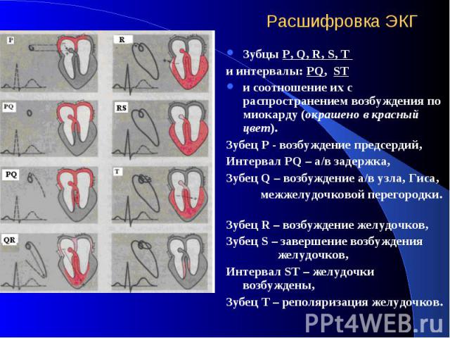 Расшифровка ЭКГ