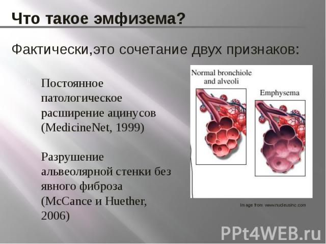 Что такое эмфизема? Постоянное патологическое расширение ацинусов (MedicineNet, 1999) Разрушение альвеолярной стенки без явного фиброза (McCance и Huether, 2006)