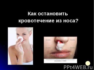 Как остановить Как остановить кровотечение из носа?