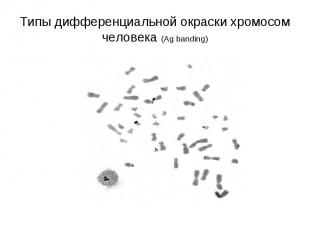 Типы дифференциальной окраски хромосом человека (Ag banding)