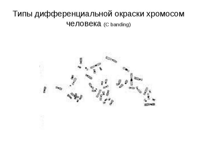 Типы дифференциальной окраски хромосом человека (С banding)