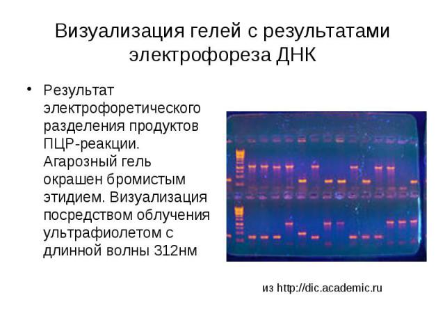 Визуализация гелей с результатами электрофореза ДНК Результат электрофоретического разделения продуктов ПЦР-реакции. Агарозный гель окрашен бромистым этидием. Визуализация посредством облучения ультрафиолетом с длинной волны 312нм