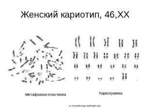 Женский кариотип, 46,ХХ