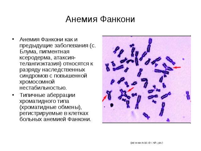 Анемия Фанкони Анемия Фанкони как и предыдущие заболевания (с. Блума, пигментная ксеродерма, атаксия-телангиэктазия) относятся к разряду наследственных синдромов с повышенной хромосомной нестабильностью. Типичные аберрации хроматидного типа (хромати…