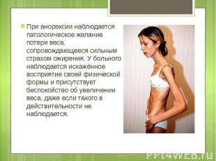 При анорексии наблюдается патологическое желание потери веса, сопровождающееся с