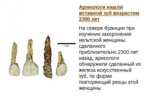 Археологи нашли вставной зуб возрастом 2300 лет Археологи нашли вставной зуб воз