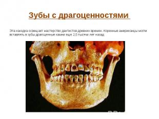 Зубы с драгоценностями Эта находка освещает мастерство дантистов древних времен.