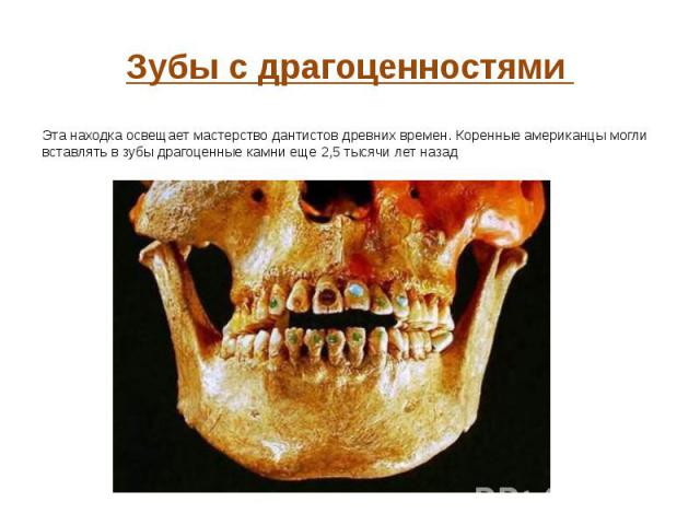 Зубы с драгоценностями Эта находка освещает мастерство дантистов древних времен. Коренные американцы могли вставлять в зубы драгоценные камни еще 2,5 тысячи лет назад