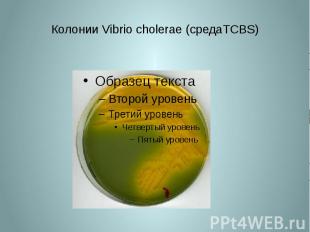 Колонии Vibrio cholerae (средаTCBS)