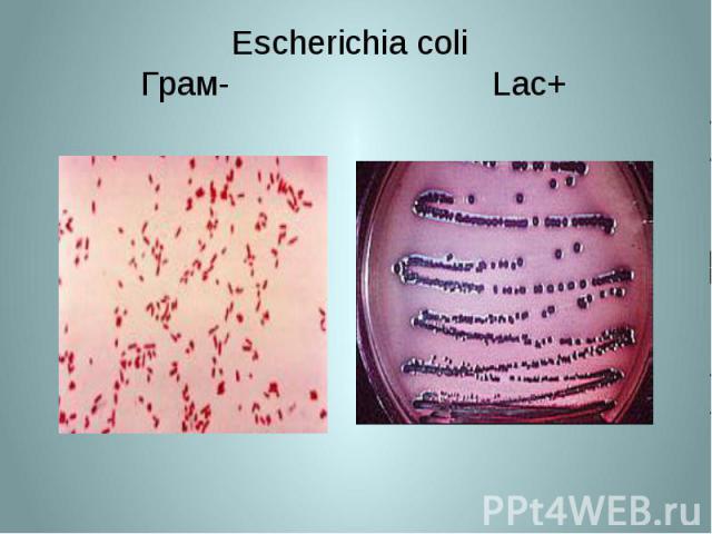 Escherichia coli Грам- Lac+
