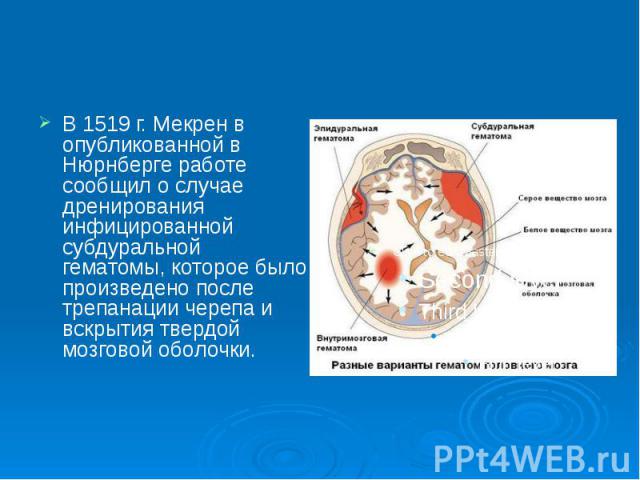 В 1519 г. Мекрен в опубликованной в Нюрнберге работе сообщил о случае дренирования инфицированной субдуральной гематомы, которое было произведено после трепанации черепа и вскрытия твердой мозговой оболочки.