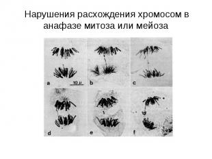 Нарушения расхождения хромосом в анафазе митоза или мейоза