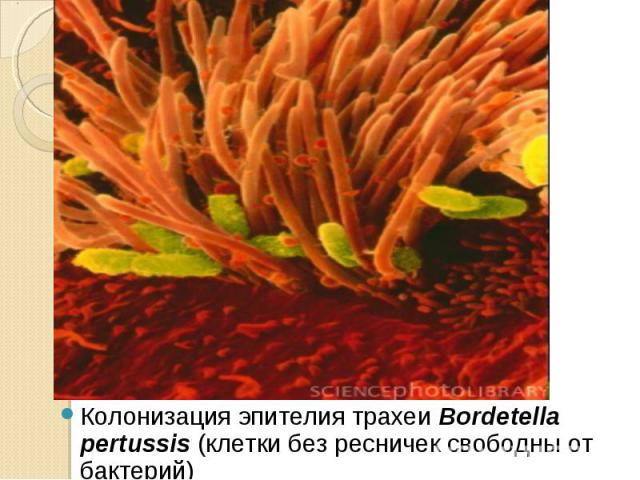Колонизация эпителия трахеи Bordetella pertussis (клетки без ресничек свободны от бактерий) Колонизация эпителия трахеи Bordetella pertussis (клетки без ресничек свободны от бактерий)