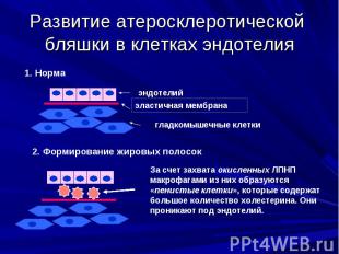 Развитие атеросклеротической бляшки в клетках эндотелия