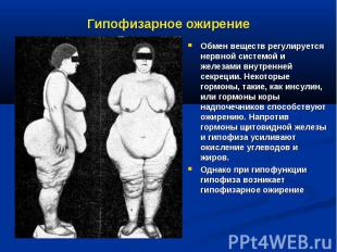 Гипофизарное ожирение Обмен веществ регулируется нервной системой и железами вну