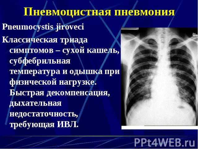 Pneumocystis jiroveci Pneumocystis jiroveci Классическая триада симптомов – сухой кашель, субфебрильная температура и одышка при физической нагрузке. Быстрая декомпенсация, дыхательная недостаточность, требующая ИВЛ.