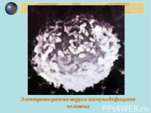 Электронограмма вируса иммунодефицита человека