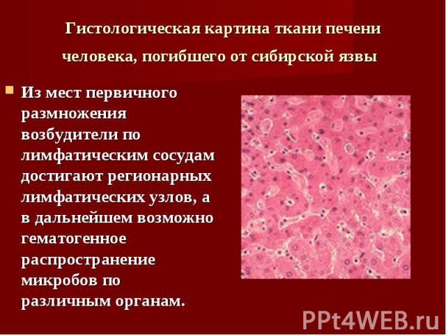 Из мест первичного размножения возбудители по лимфатическим сосудам достигают регионарных лимфатических узлов, а в дальнейшем возможно гематогенное распространение микробов по различным органам. Из мест первичного размножения возбудители по лимфатич…