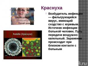 Краснуха Возбудитель инфекции — фильтрующийся вирус, имеющий сходство с коревым.