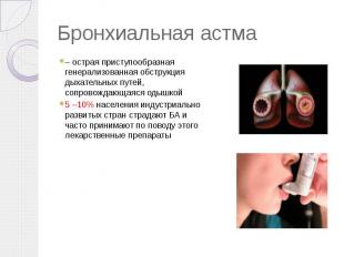 Бронхиальная астма – острая приступообразная генерализованная обструкция дыхател