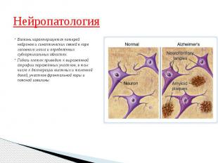 Нейропатология Болезнь характеризуется потерей нейронов и синаптических связей в