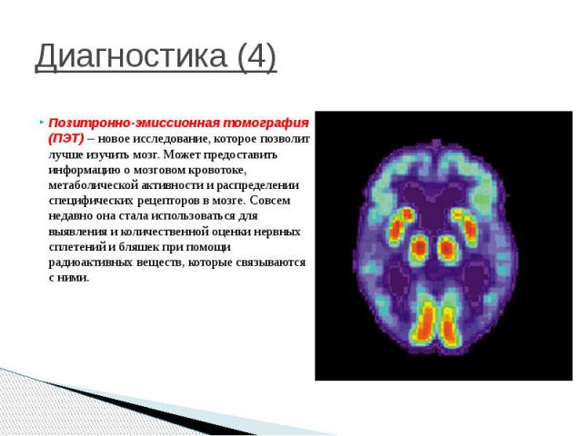 Метаболическая активность на пэт. Позитронно-эмиссионная томография. Позитронно-эмиссионная томография мозга. Позитрон-эмиссионная  томография: ПЭТ. Позитронно эмиссионная томография болезнь Альцгеймера.