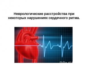 Неврологические расстройства при некоторых нарушениях сердечного ритма.