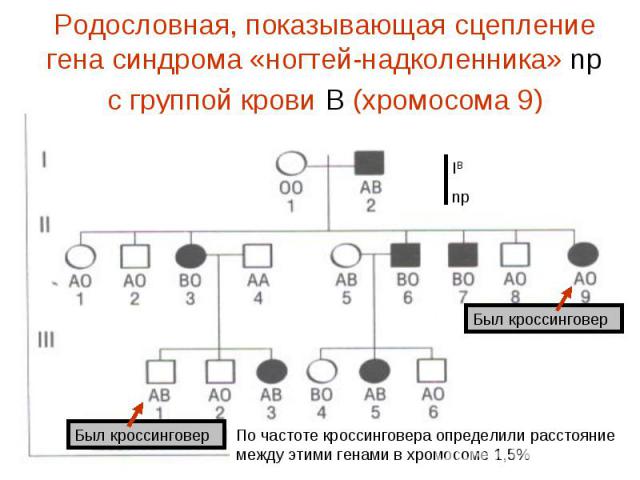 Родословная, показывающая сцепление гена синдрома «ногтей-надколенника» np с группой крови В (хромосома 9)