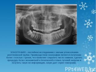 ЗОНОГРАФИЯ – послойное исследование с малым углом качания рентгеновской трубки.