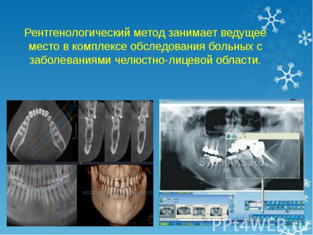 Рентгенологический метод занимает ведущее место в комплексе обследования больных с заболеваниями челюстно-лицевой области.