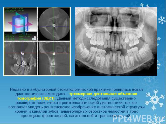 Недавно в амбулаторной стоматологической практике появилась новая диагностическая методика – трехмерная дентальная объемная томография (3ДКТ). Данный метод исследования существенно расширяет возможности рентгенологической диагностики, так как позвол…