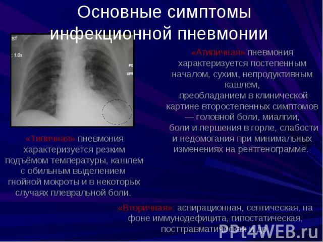 Основные симптомы инфекционной пневмонии