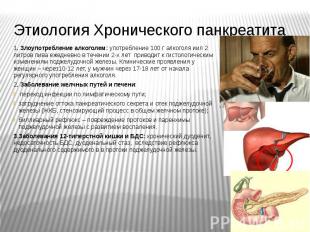 Этиология Хронического панкреатита 1. Злоупотребление алкоголем: употребление 10