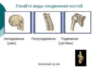 Узнайте виды соединения костей Неподвижное Полуподвижное Подвижное (швы) (сустав