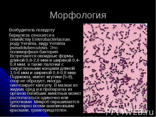 Морфология Возбудитель псевдоту беркулеза относится к семейству Enterobacteriaceae, роду Yersinia, виду Yersinia pseudotuberculosis. Это полиморфная бактерия. Встречаются овоидные формы длиной 0,8-2,0 мкм и шириной 0,4-0,8 м…