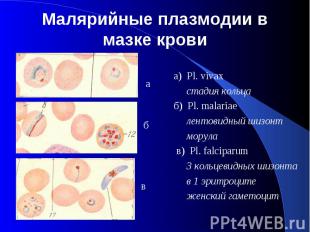 Малярийные плазмодии в мазке крови а) Pl. vivax стадия кольца б) Pl. malariae ле