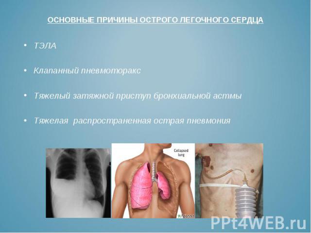 ТЭЛА ТЭЛА Клапанный пневмоторакс Тяжелый затяжной приступ бронхиальной астмы Тяжелая распространенная острая пневмония