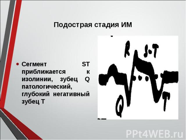 Сегмент ST приближается к изолинии, зубец Q патологический, глубокий негативный зубец Т Сегмент ST приближается к изолинии, зубец Q патологический, глубокий негативный зубец Т