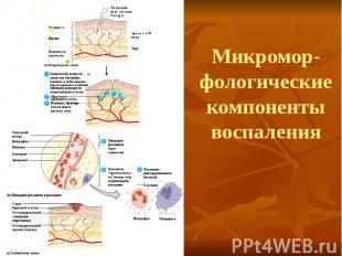 Микромор-фологические компоненты воспаления