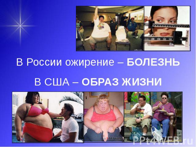В России ожирение – БОЛЕЗНЬ В России ожирение – БОЛЕЗНЬ В США – ОБРАЗ ЖИЗНИ