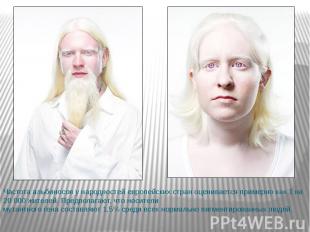 Частота альбиносов у народностей европейских стран оценивается примерно как 1 на
