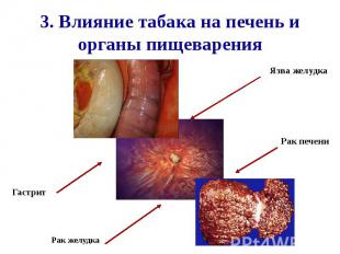 3. Влияние табака на печень и органы пищеварения