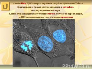 Клетки Hela, ДНК которых окрашено голубым красителем Хойста. Центральная и права