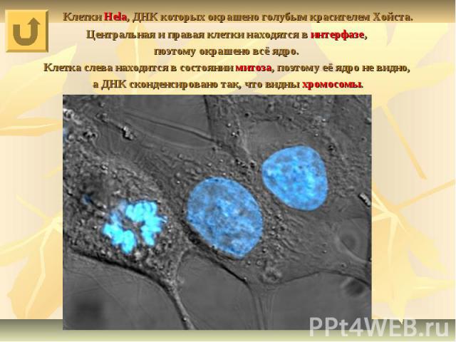 Клетки Hela, ДНК которых окрашено голубым красителем Хойста. Центральная и правая клетки находятся в интерфазе, поэтому окрашено всё ядро. Клетка слева находится в состоянии митоза, поэтому её ядро не видно, а ДНК сконденсировано так, что видны хромосомы.