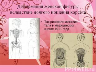 Так рисовали женские тела в медицинских книгах 1911 года